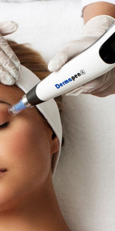 a woman getting a dermapen 4 procedure on her forehead