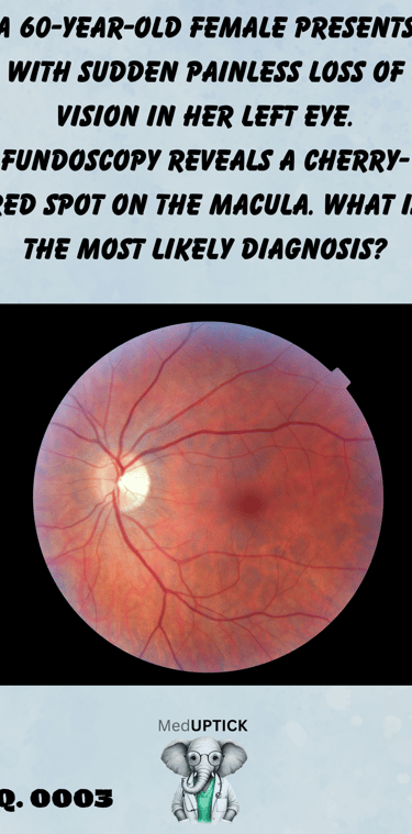 fundoscopy image of a cherry red spot