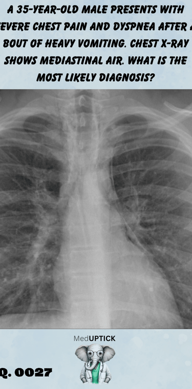 a chest x-ray with mediastinal air