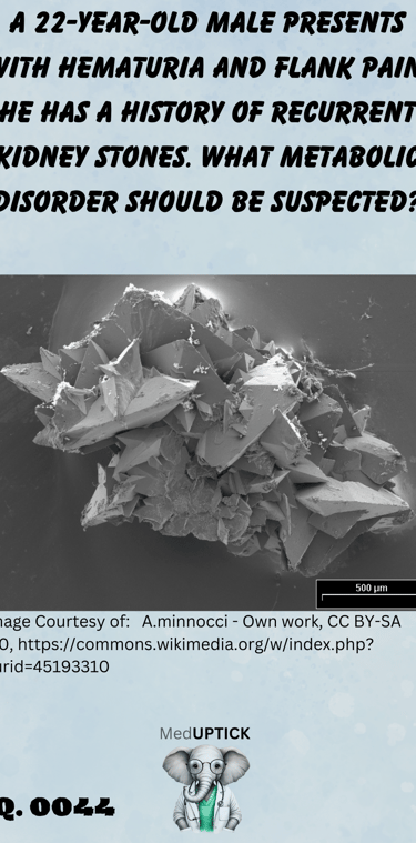 3-D spectrometry of a kidney stone