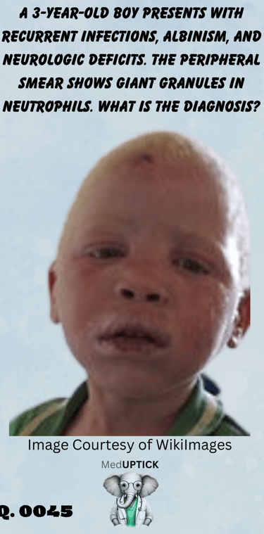 a young African American boy with albinism