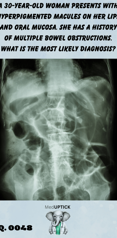 an abdominal x-ray demonstrating bowel obstruction