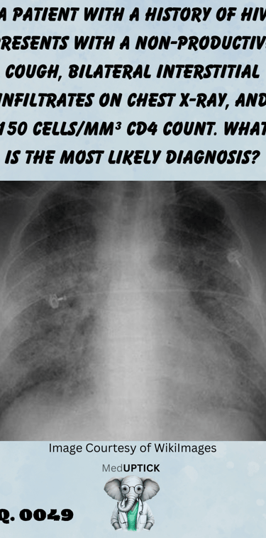 a chest x-ray with bilateral infiltrates