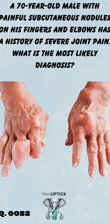 a close up of an elderly patients hands with disfigurement and joint masses