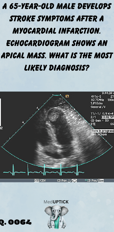 an echocardiogram image displaying an apical mass