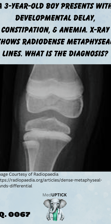 an x-ray of the knee with radiodense metaphyseal lines of a toddler