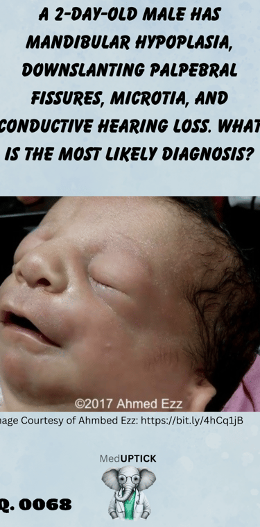 a neonate with mandibular hypoplasia, downslanting palpebral fissures, and microtia