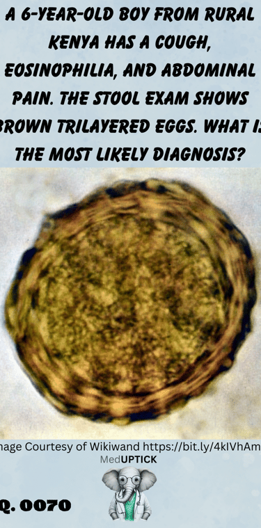 stool microscopy of a brown trilayered egg