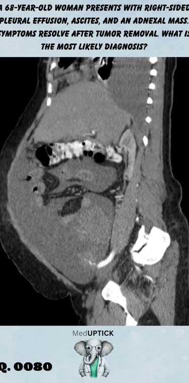 a sagital CT scan image demonstrating abdominal ascites