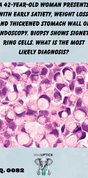 a histology slide showing signet ring cells