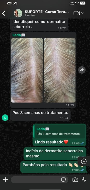 CURSO DE TERAPIA CAPILAR