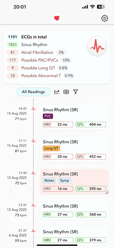 Home page of ECG+ app showing Apple Watch ECG analysis with Atrial Fibrillation, PAC/PVC and Long QT