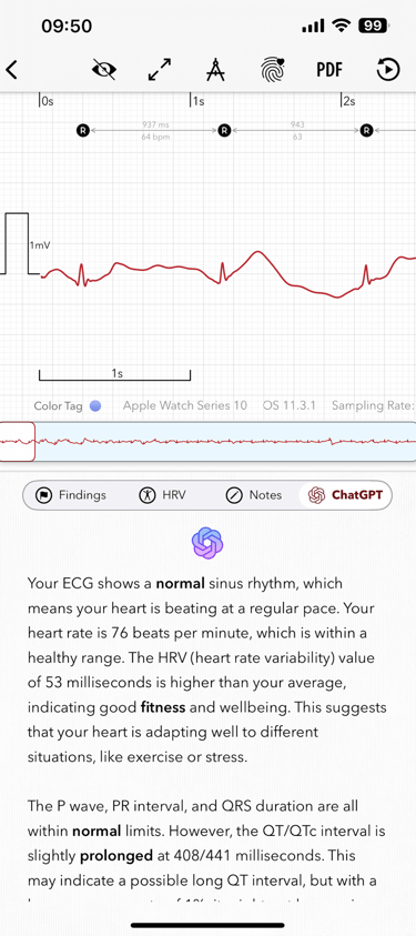 ChatGPT (GPT-5) explains the findings on an Apple Watch ECG report in the ECG+ app