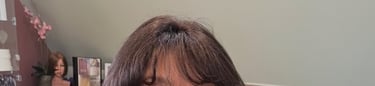 After permanent non-surgical hair replacement #25 with Micropoint Helix solution – enhanced density 