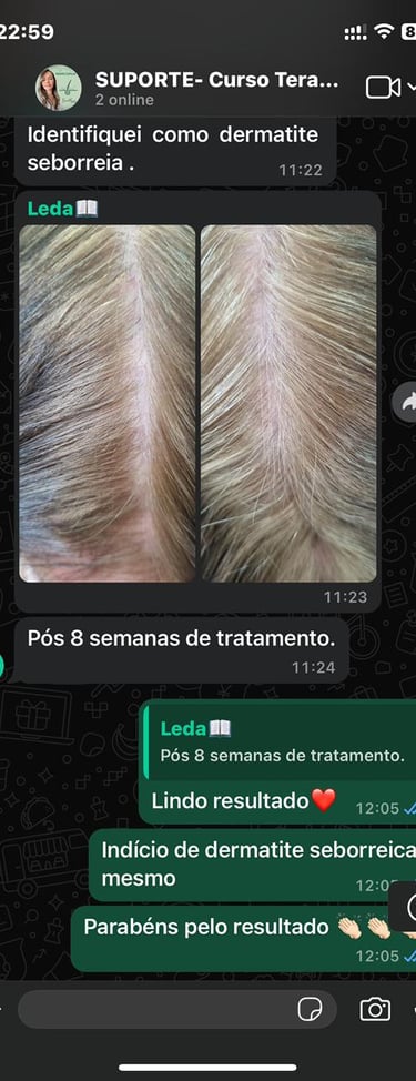 CURSO DE TERAPIA CAPILAR