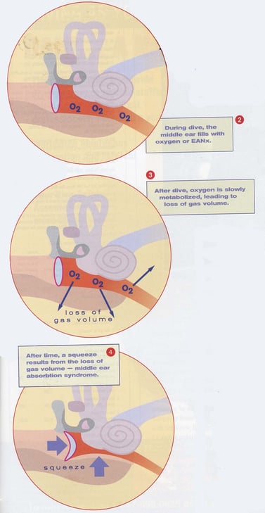 Middle Ear Oxygen Absorption