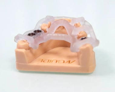 Precio de implantes dentales en sevilla
