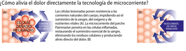 Funcionamiento microcorrientes MCPATCH