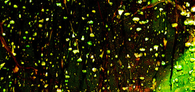 RF# 02 “Raindrops Series”