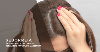 seborreia, dermatite no couro cabeludo