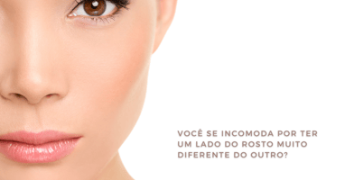 assimetria rosto