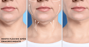 a woman with a facelift and a noseplant