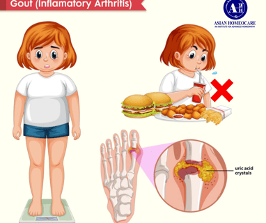 Gout