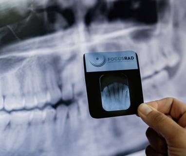 Evaluación de Radiografía