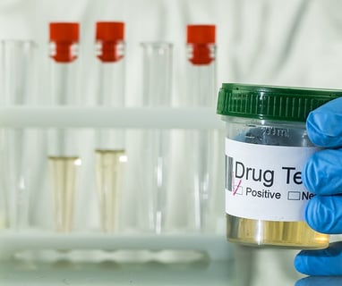 a person in a lab coat holding a bottle of urine