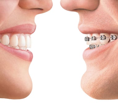 orthodontie alfortville Invisalign Dr Der Arminee
