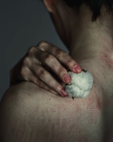 Alodinia fibromilagia fatiga crónica proyecto fibroespejo autorretrato fraga huesca lleida fotógrafo