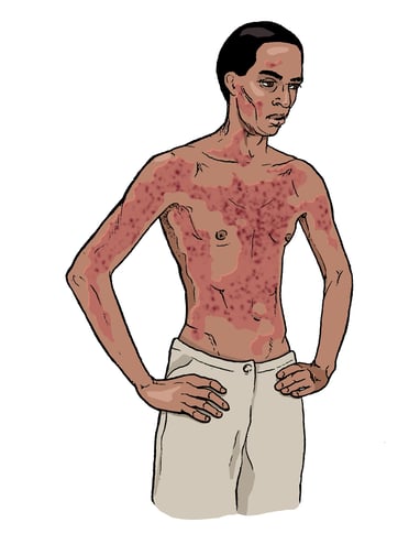 ebola virus causes and treatment