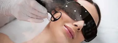 Acne Scars ray and rio's speciality clinic