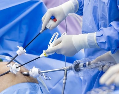 laparoscopic surgery, minimum invasive surgery