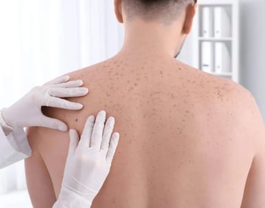 Dermato em Paulinia