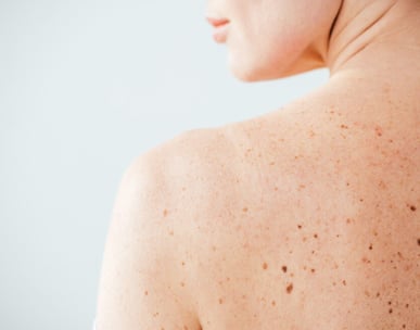 Dermatologia Paulinia