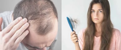 Hair Growth RX ray and rio's speciality clinic