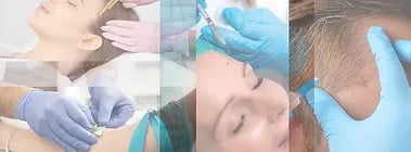 PRP ray and rio's speciality clinic