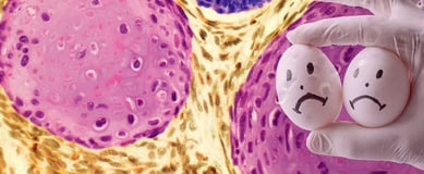 Testicular Cancer  ray and rio's speciality clinic