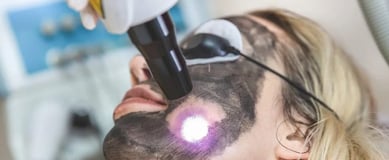 Carbon Laser Peel  ray and rio's speciality clinic