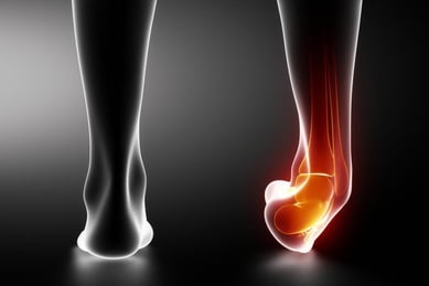 cheville inflammée