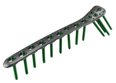 Placa para Fémur Proximal Lateral