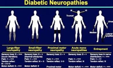 diabetic neuropath