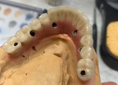 Procad Henares, rehabilitación inferior metal cerámica