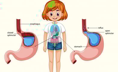 gerd and chest pain