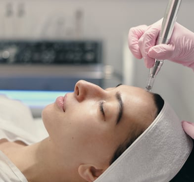 a woman is getting her face microneedled