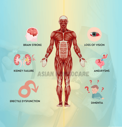 Complications of Hypertension