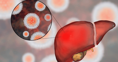Hepatitis B Hepatitis C Ahmedabad treatment