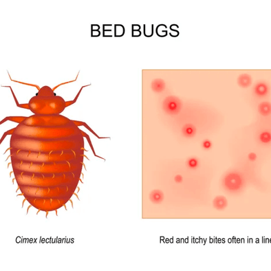 what do bed bugs bites look like