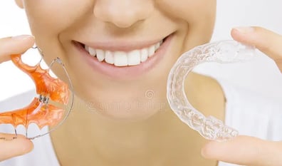 Retainer gigi di Sidharta Dental Studio Malang untuk menjaga hasil perawatan ortodonti